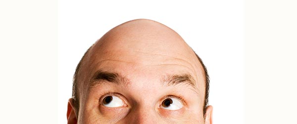 Боротьба з облисінням 2